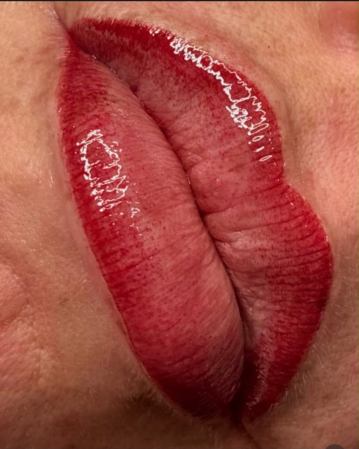 Lip Blush — symmetry, defined border, hydrated tissue